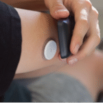 Transforming diabetes care with Continuous Glucose Monitoring (CGM)