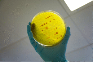 How AMR is spreading unchecked through unregulated drug sales in Nigeria